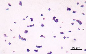 Pneumonia causada por Staphylococcus aureus e a problemática da resistência bacteriana