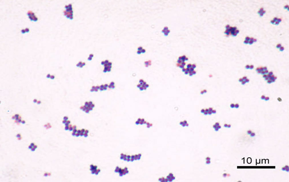 Staphylococcus_aureus_Gram2